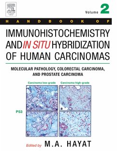 Handbook of Immunohistochemistry and in Situ Hybridization of Human Carcinomas (eBook, PDF)