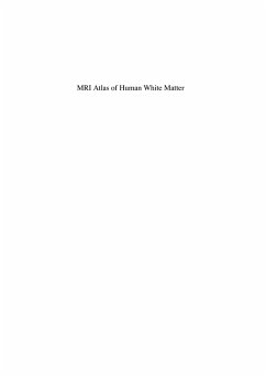 MRI Atlas of Human White Matter (eBook, PDF) - Mori, Susumu; Wakana, S.; Zijl, Peter C M van; Nagae-Poetscher, L. M.