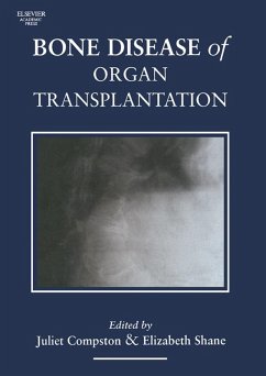 Cover Bone Disease of Organ Transplantation (eBook, ePUB)