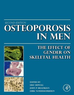 Osteoporosis in Men (eBook, ePUB)