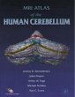 MRI Atlas of the Human Cerebellum... - Bild 1