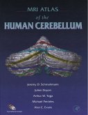 MRI Atlas of the Human Cerebellum (eBook, PDF)