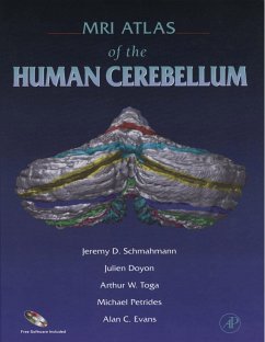 MRI Atlas of the Human Cerebellum (eBook, PDF) - Schmahmann, Jeremy D.; Doyon, Julien; Petrides, Michael; Evans, Alan C.; Toga, Arthur W.