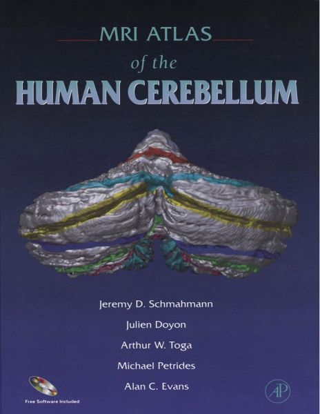 MRI Atlas of the Human Cerebellum (eBook, PDF) MRI Atlas of the Human Cerebellum (eBook, PDF)