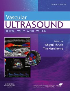 Vascular Ultrasound (eBook, ePUB) - Thrush, Abigail; Hartshorne, Timothy