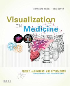 Visualization in Medicine (eBook, PDF) - Preim, Bernhard; Bartz, Dirk