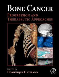 Cover Bone Cancer (eBook, ePUB)