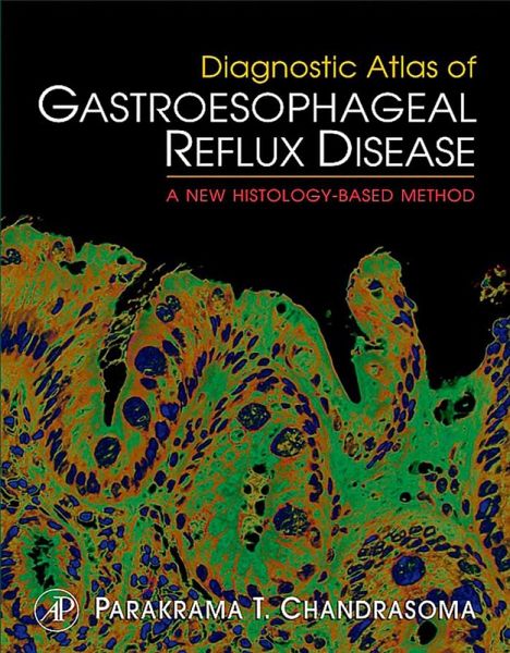 Diagnostic Atlas of Gastroesophageal Reflux Disease (eBook, PDF)