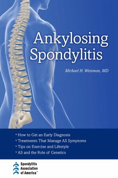 Cover Ankylosing Spondylitis (eBook, PDF)