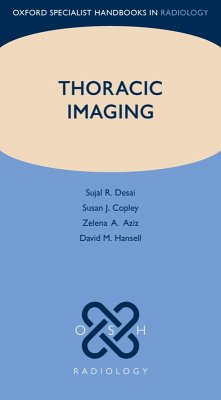 Thoracic Imaging (eBook, ePUB) - Desai, Sujal R.; Copley, Susan J.; Aziz, Zelena A.; Hansell, David M.