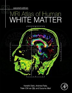 MRI Atlas of Human White Matter (eBook, ePUB) - Oishi, Kenichi; Faria, Andreia V.; Zijl, Peter C M van; Mori, Susumu