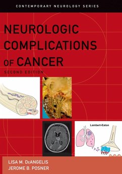 Cover Neurologic Complications of Cancer (eBook, PDF)