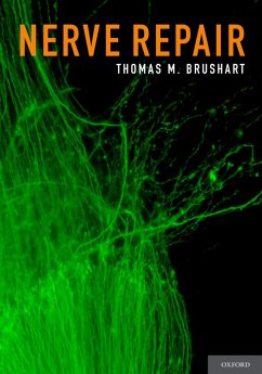Cover Nerve Repair (eBook, PDF)