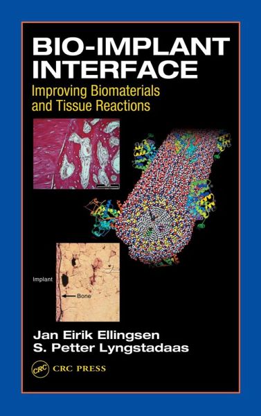 Bio-Implant Interface (eBook, PDF) Bio-Implant Interface (eBook, PDF)