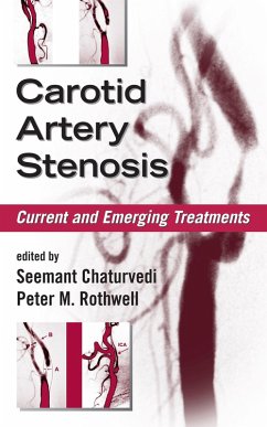 Carotid Artery Stenosis (eBook, PDF) Cover Carotid Artery Stenosis (eBook, PDF)