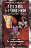Angiography and Plaque Imaging (eBook, PDF)
