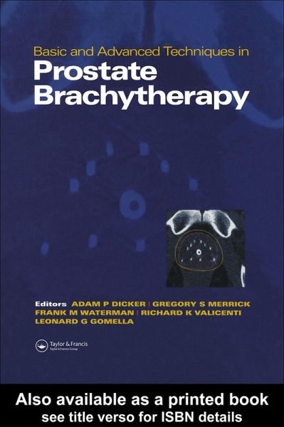 Basic and Advanced Techniques in Prostate Brachytherapy (eBook, PDF) Basic and Advanced Techniques in Prostate Brachytherapy (eBook, PDF)