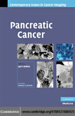 Cover Pancreatic Cancer (eBook, PDF)