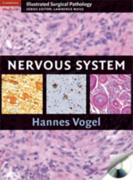 Nervous System (eBook, PDF) Nervous System (eBook, PDF)