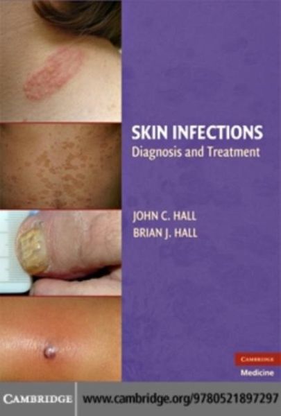 Skin Infections (eBook, PDF)