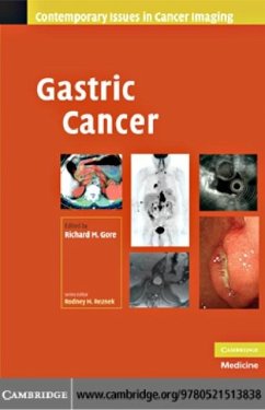 Cover Gastric Cancer (eBook, PDF)