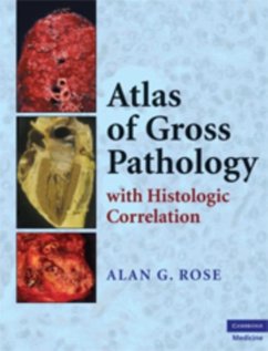 Atlas of Gross Pathology (eBook, PDF) - Rose, Alan G.