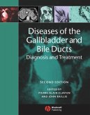 Diseases of the Gallbladder and Bile Ducts (eBook, PDF)
