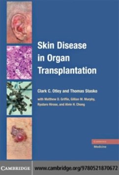 Cover Skin Disease in Organ Transplantation (eBook, PDF)