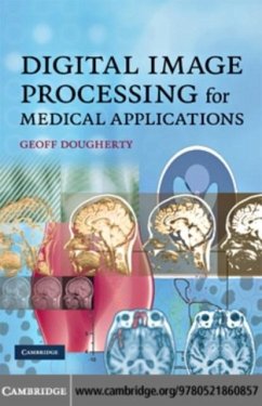 Digital Image Processing for Medical Applications (eBook, PDF) - Dougherty, Geoff
