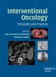 Interventional Oncology (eBook, PDF) - Bild 1