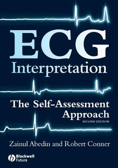 ECG Interpretation (eBook, PDF) - Abedin, Zainul; Conner, Robert