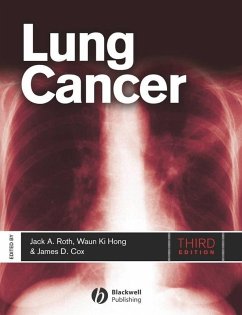 Cover Lung Cancer (eBook, PDF)