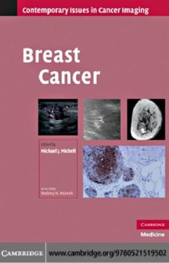 Breast Cancer (eBook, PDF)