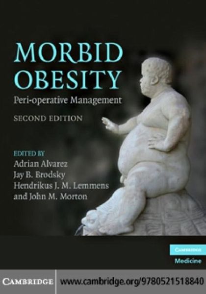 Morbid Obesity (eBook, PDF) Morbid Obesity (eBook, PDF)