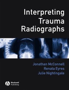 Interpreting Trauma Radiographs (eBook, PDF)