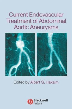 Current Endovascular Treatment of Abdominal Aortic Aneurysms (eBook, PDF) Current Endovascular Treatment of Abdominal Aortic Aneurysms (eBook, PDF)