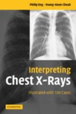 Cover Interpreting Chest X-Rays (eBook, PDF)