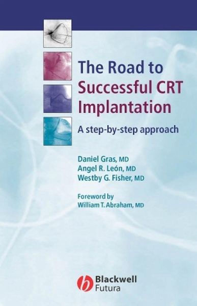 The Road to Successful CRT Implantation (eBook, PDF) The Road to Successful CRT Implantation (eBook, PDF)