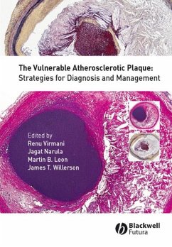 Cover The Vulnerable Atherosclerotic Plaque (eBook, PDF)