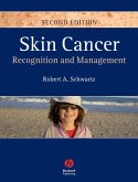 Skin Cancer (eBook, PDF)