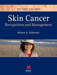 Skin Cancer (eBook, PDF) - Schwartz, Robert A.