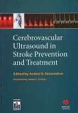 Cerebrovascular Ultrasound in Stroke Prevention and Treatment (eBook, PDF)