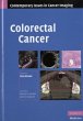 Colorectal Cancer (eBook, PDF) - Bild 1