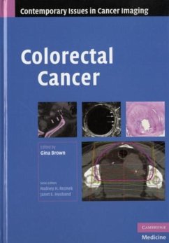 Cover Colorectal Cancer (eBook, PDF)