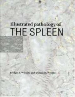Cover Illustrated Pathology of the Spleen (eBook, PDF)