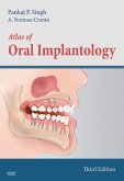 Atlas of Oral Implantology - E-Book (eBook, ePUB)