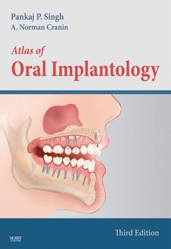 Atlas of Oral Implantology - E-Book (eBook, ePUB) - Singh, Pankaj; Cranin, A. Norman
