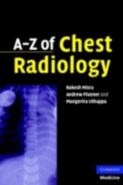 Cover A-Z of Chest Radiology (eBook, PDF)
