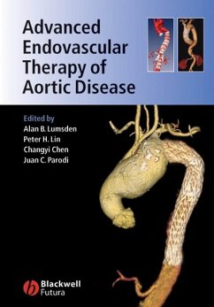 Cover Advanced Endovascular Therapy of Aortic Disease (eBook, PDF)