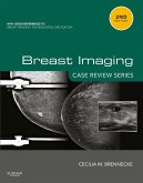 Breast Imaging: Case Review Series E-Book (eBook, ePUB)